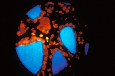 Superposition d'images obtenues en microscopie ionique d'un échantillon de thyroïde.