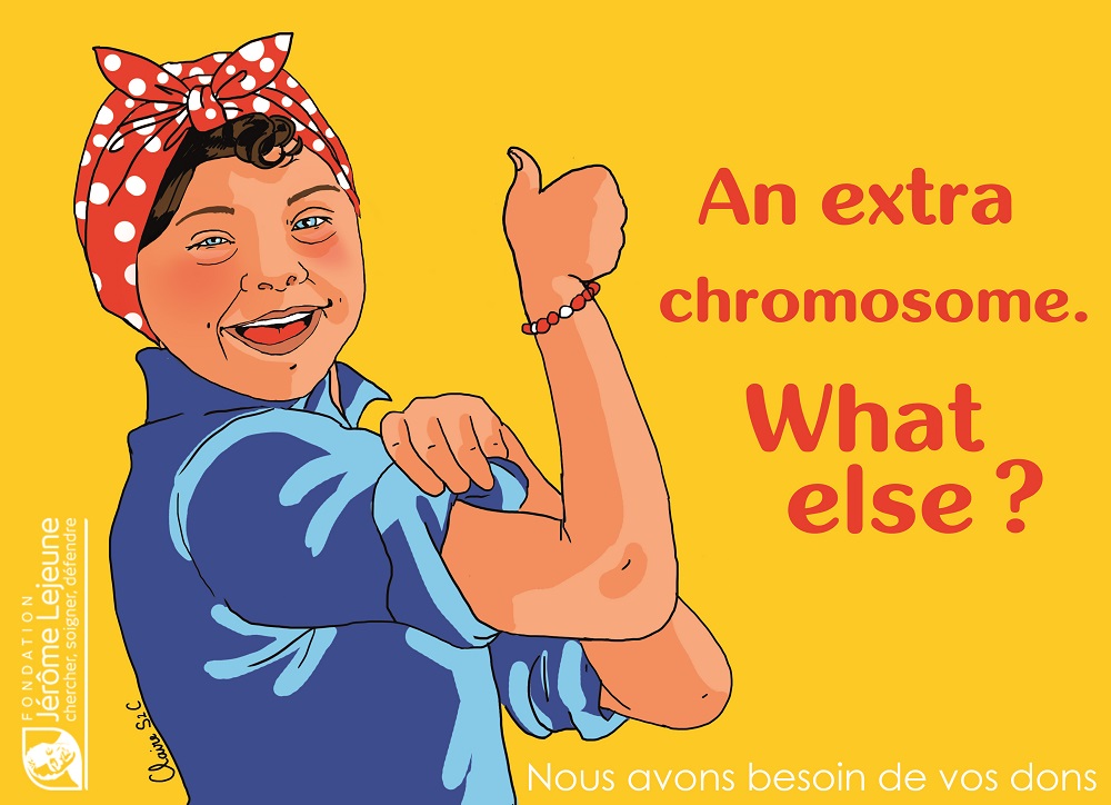 An extra Chromosome