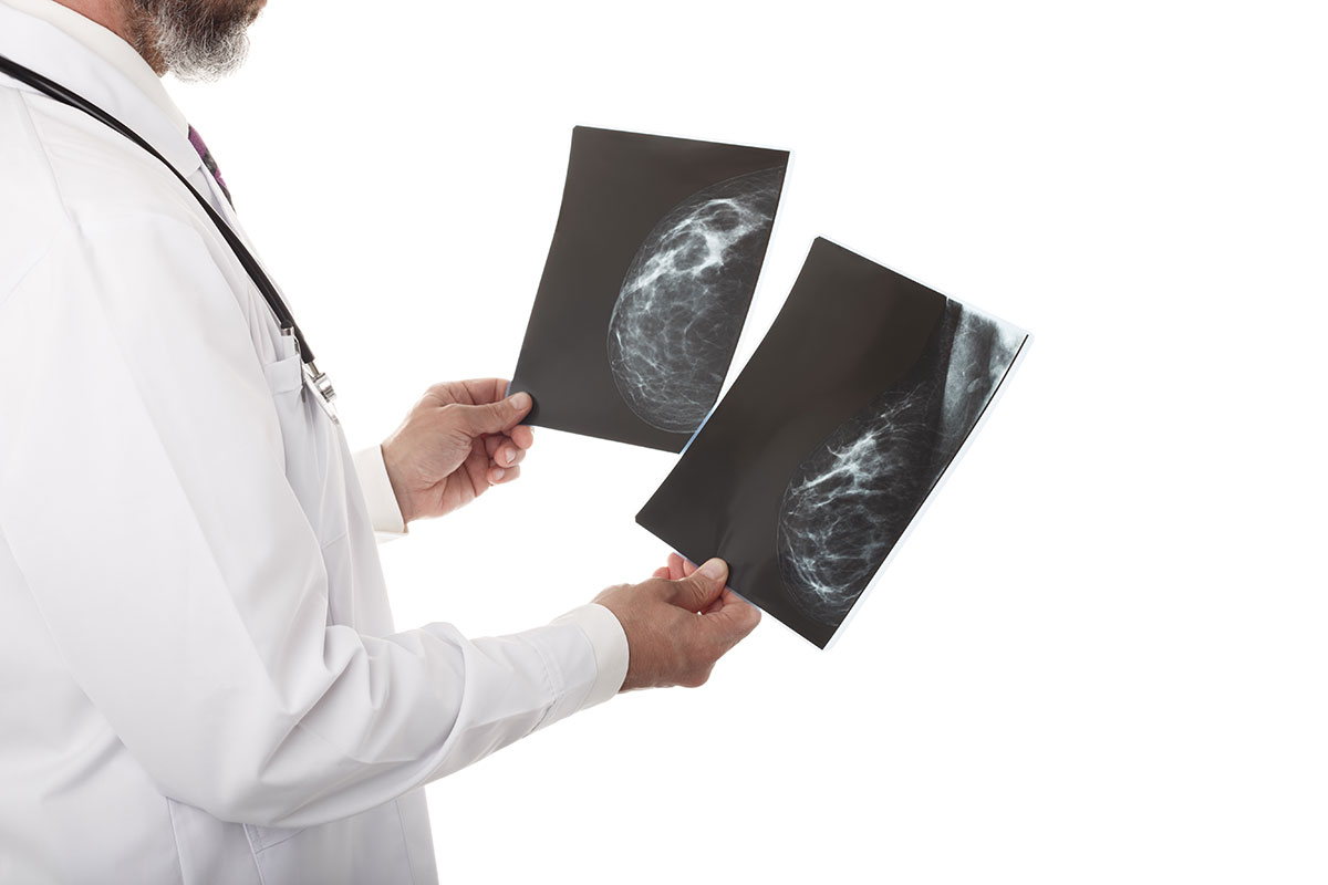 doctor-with-breast-xray-SNCQ2HZ